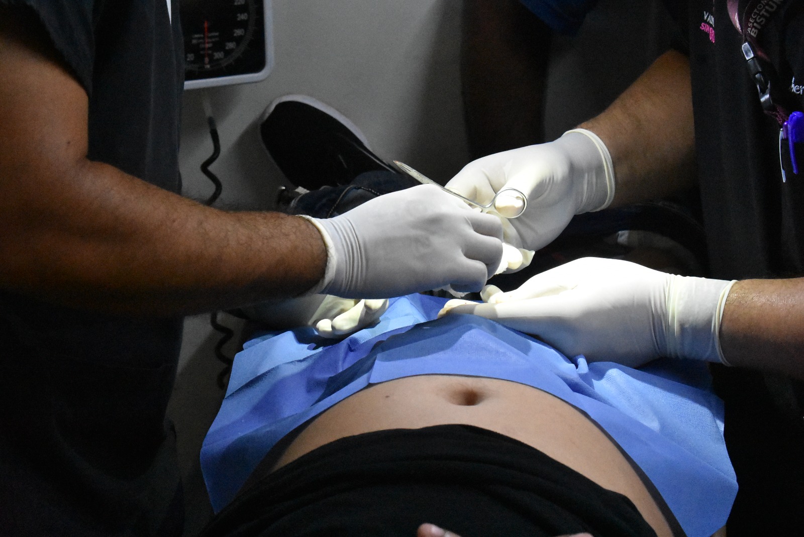 Realiza Salud jornada gratuita de vasectomía sin bisturí en Centro