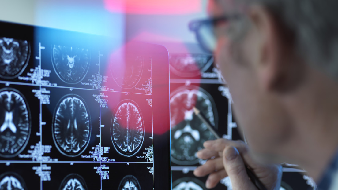 Déficit de omega-3 podría aumentar el riesgo de Alzheimer, advierte especialista